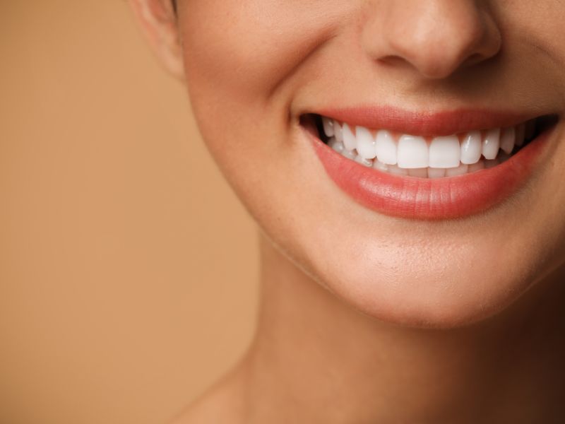 dental crowns in tampa